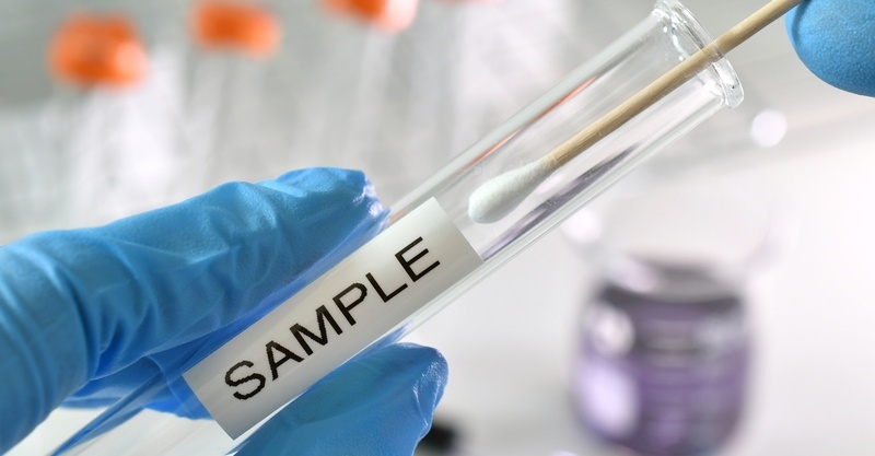 When to get tested for STDs: What you need to know