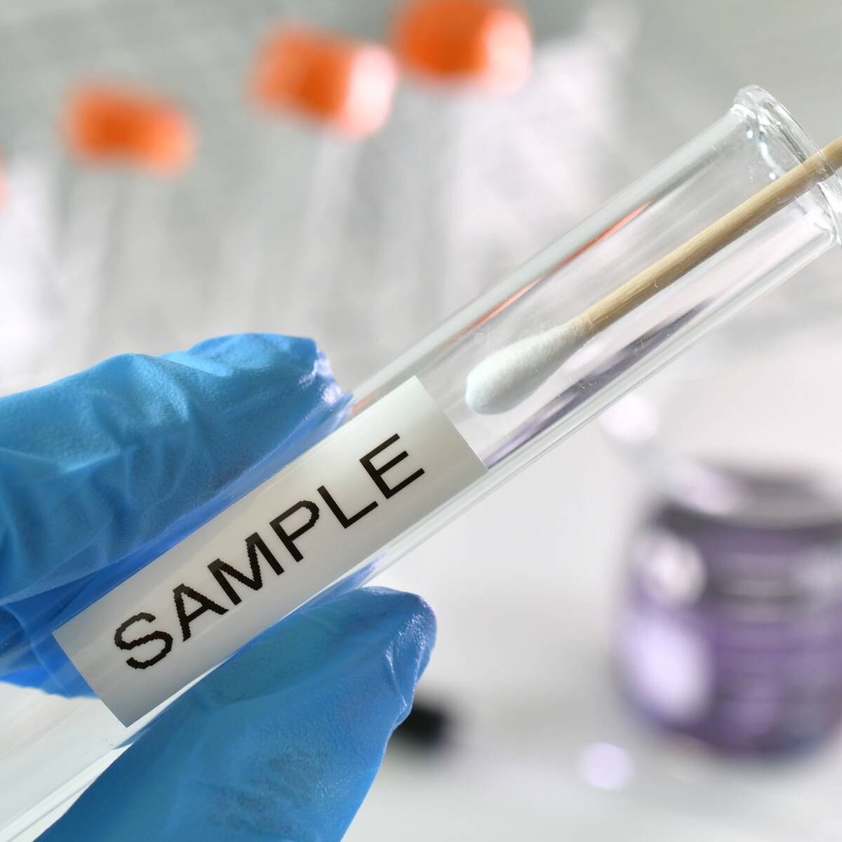 When to Get Tested for STDs: What You Need to Know