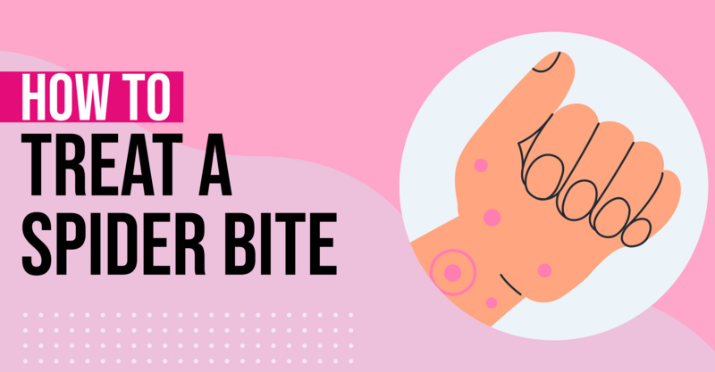 How to treat a spider bite: 9 soothing remedies