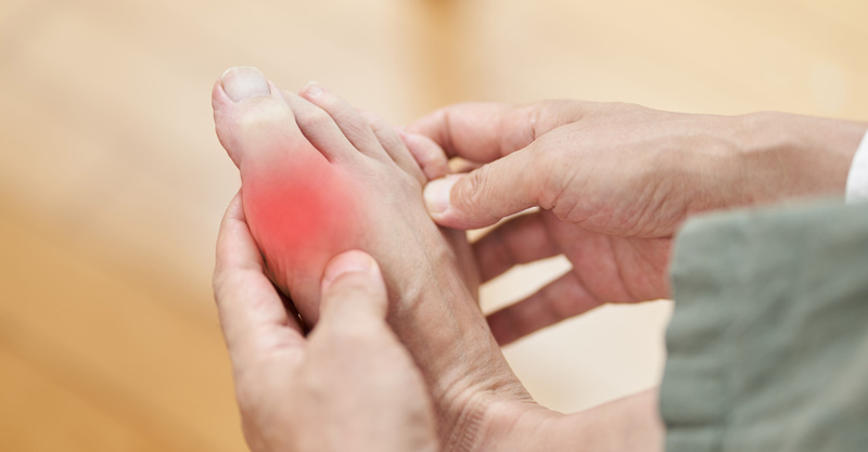 Gout: Tests, treatment and diagnosis