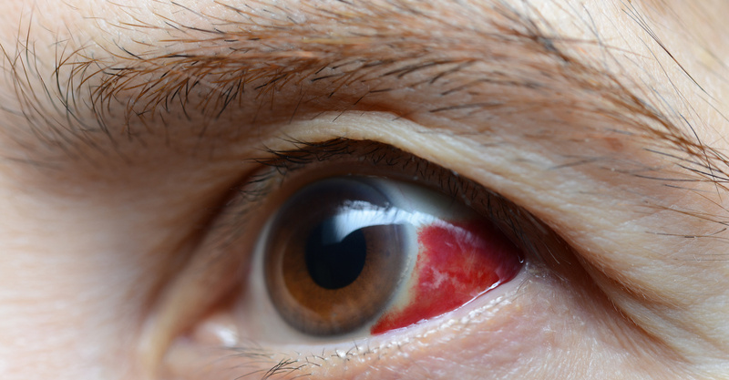 Hemorrhage: Symptoms, first aid, and when to call 911