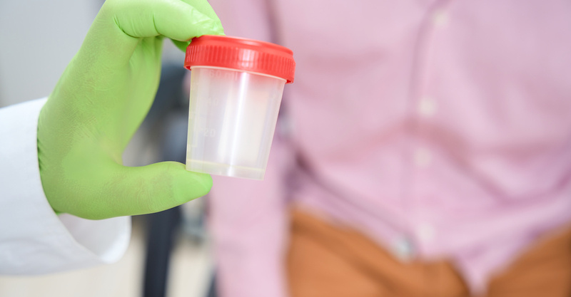Stool test: Definition, types, results, & purpose