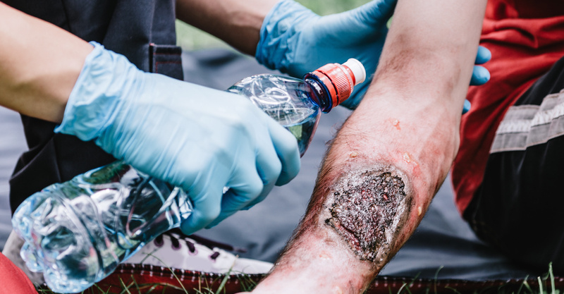 Fourth-degree burns: Types, symptoms, and treatment
