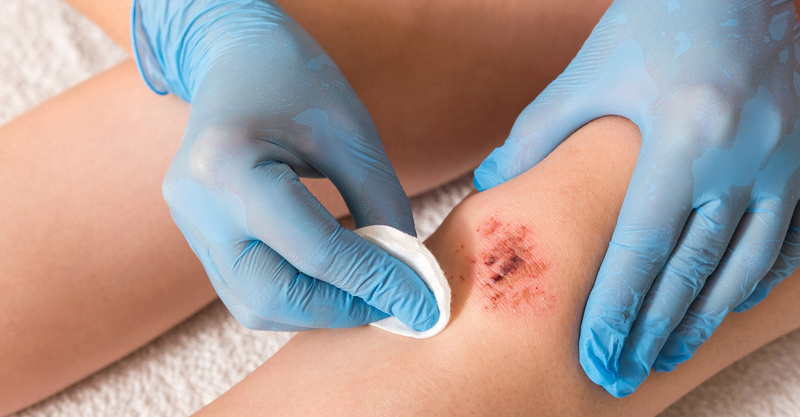 How to tell if a wound is healing or infected