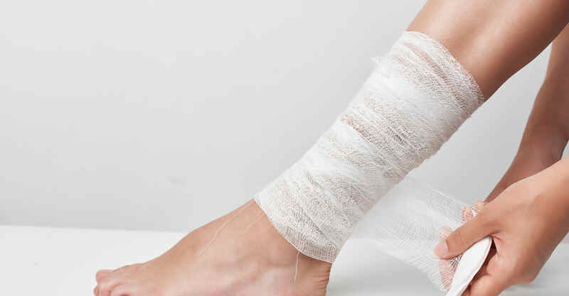 Burn Healing Stages: What to Expect