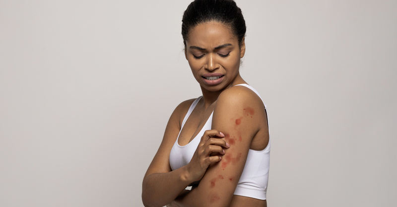 Red spots on skin: Causes & treatment