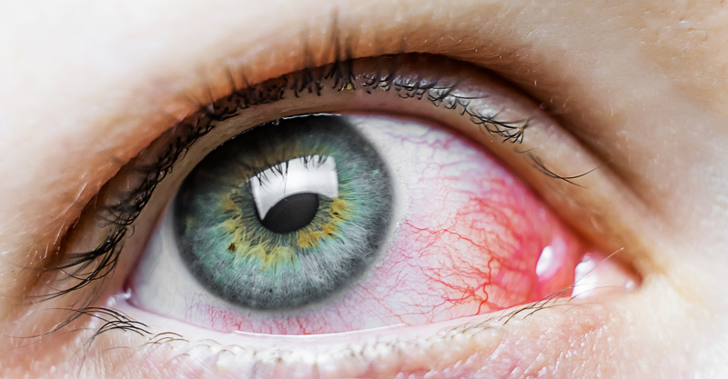 Viral vs bacterial pink eye: Understanding conjunctivitis