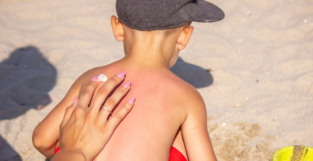 The best ways to prevent heat rash (especially for kids)