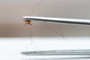 Tick bites: When to visit urgent care for Lyme disease prevention