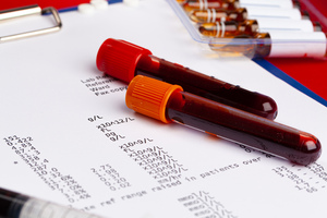 Can lab testing help with weight loss? What you should know