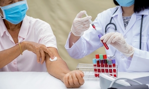 Common lab tests you should get annually for better health