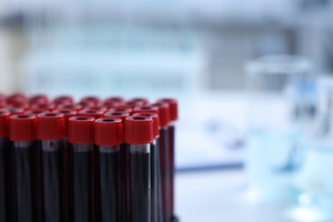 Complete guide to lab tests