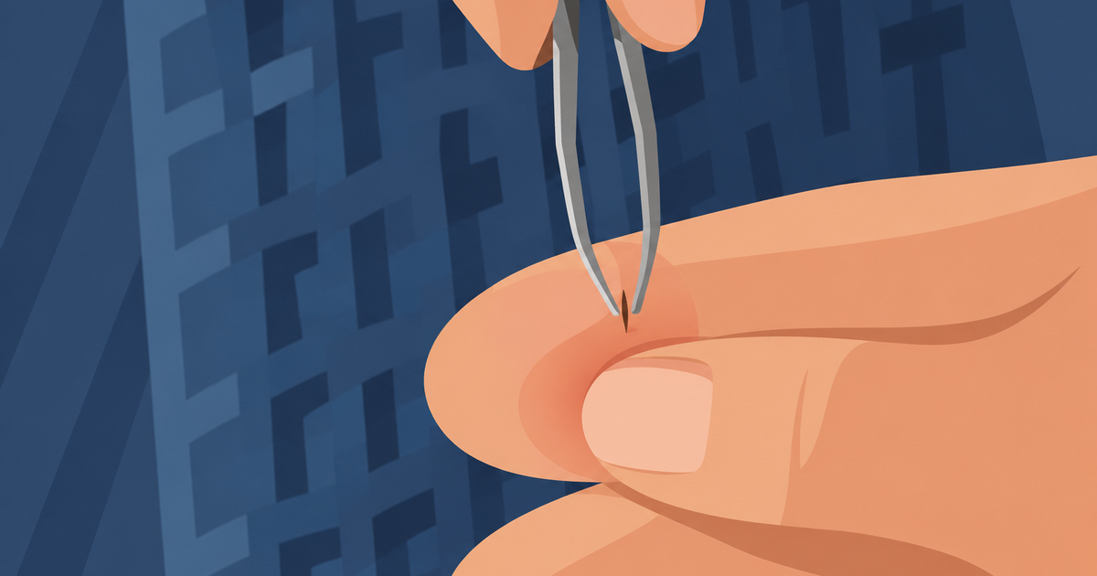 How to remove a splinter at home: Safe methods and when to see a doctor
